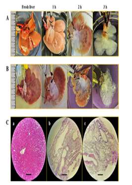 MMP inhibition as a novel strategy for extracellular matrix preservation during whole liver decellularization